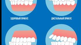Как правильно писать 